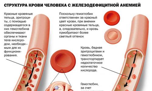 شدت کم خونی بر اساس سطح هموگلوبین